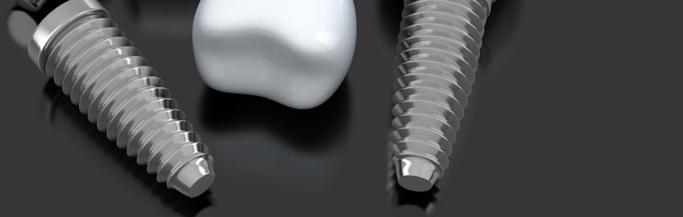 implanty gniezno, ortodonta gniezno