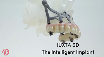 Implanty podokostnowe Iuxta 3D | Wszczepy podokostnowe | Siatki podokostnowe